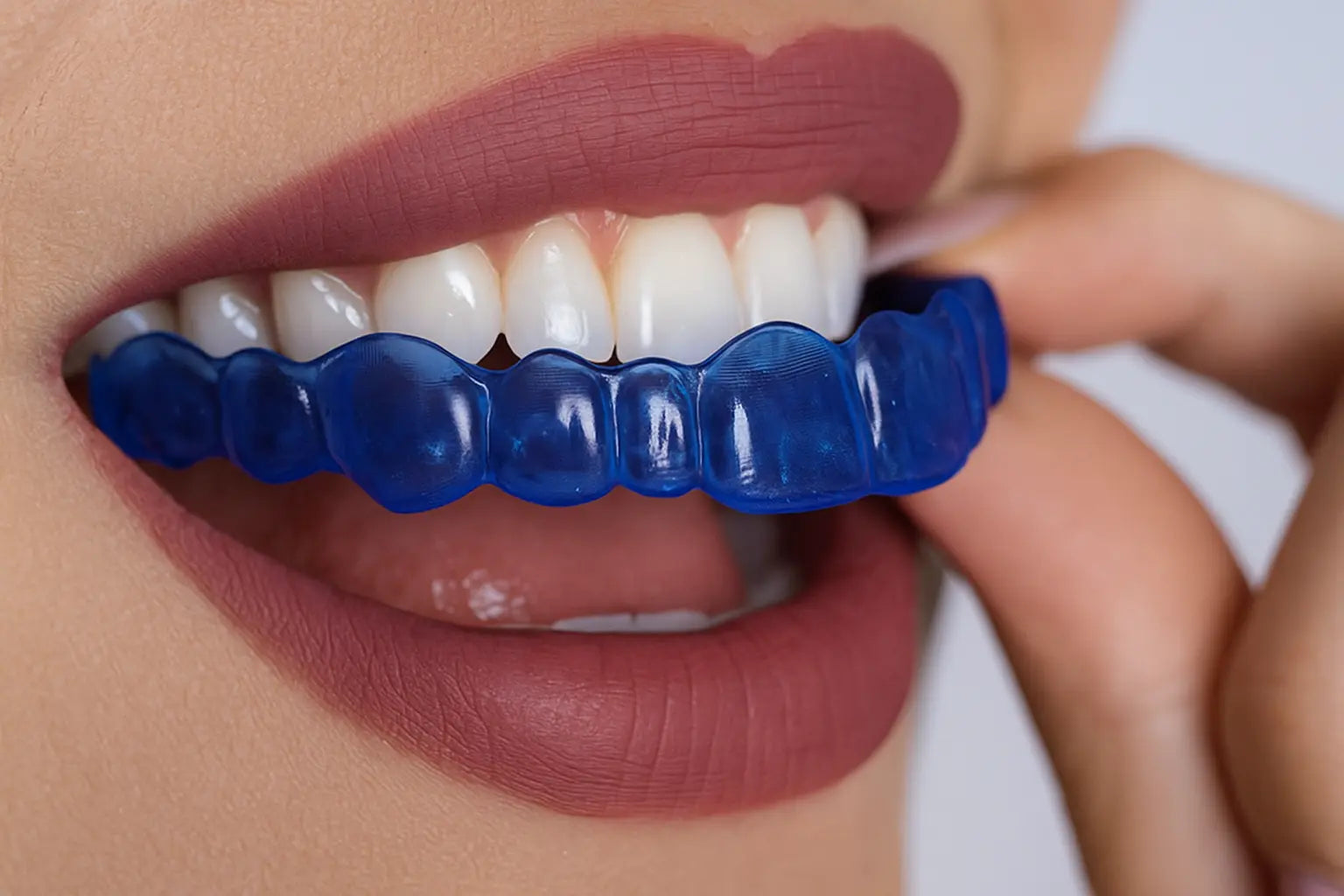 Night Shield Dental - Custom mouldable multicolour nightguard